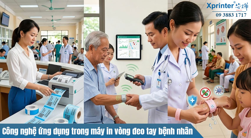 Công nghệ ứng dụng trong máy in vòng đeo tay bệnh nhân